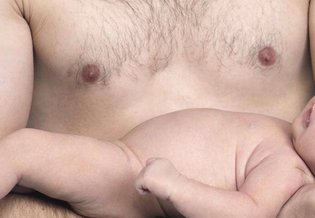 La Roche Posay Concern Page Eczema Header